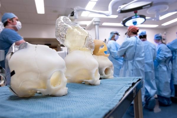 Американские врачи с помощью 3D-печати спасли жизнь младенца, мозг которого выходил за границы черепа